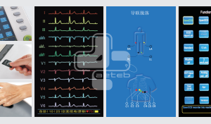 الکتروکاردیوگرافی Zonecare 12 کاناله