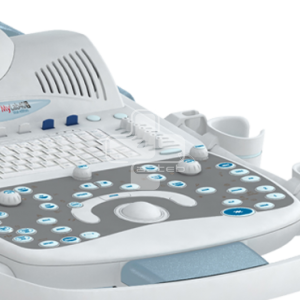 اکوکاردیوگرافی اکوکاردیوگرافی