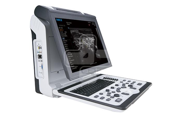 قیمت دستگاه سونوگرافی Siui دستگاه سونوگرافی siui