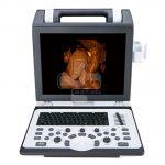 سونوگرافی Siui مدل Apogee-2100